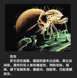 绍兴新闻爆料平台蜱虫,惊现蜱虫隐患，专家提醒防范措施！  第1张